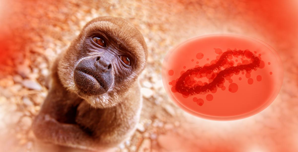 variole du singe