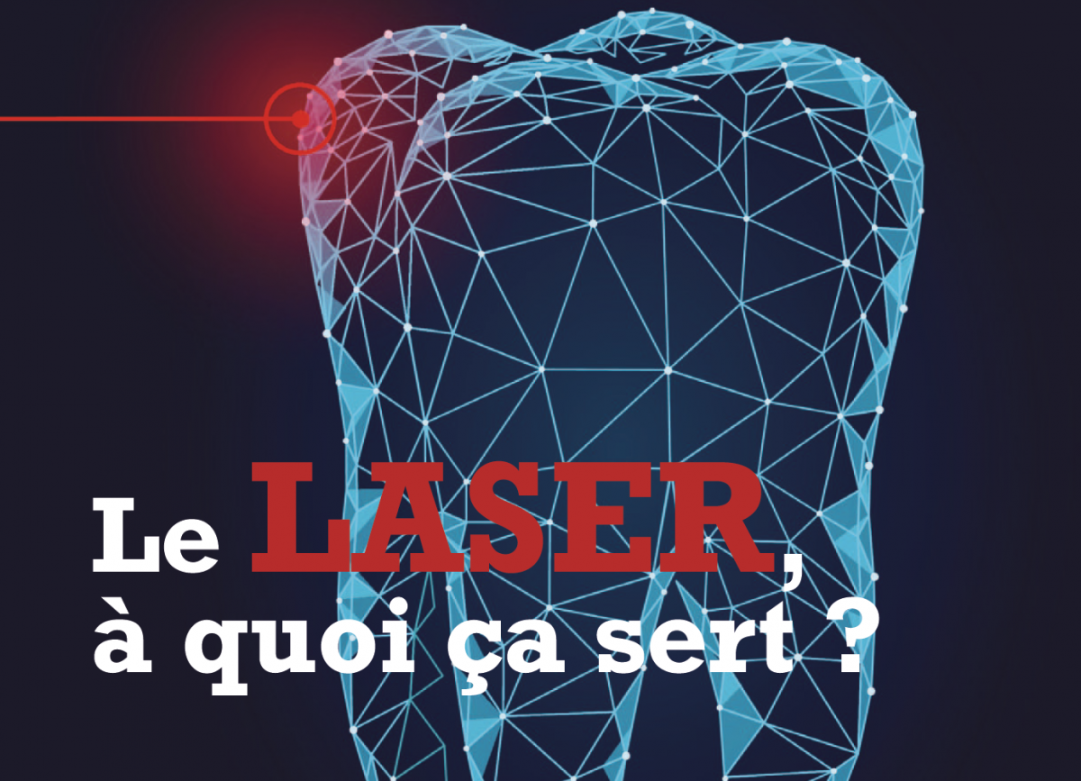 laser